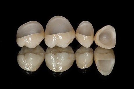 Guía práctica para limpiar una corona de metal en casa