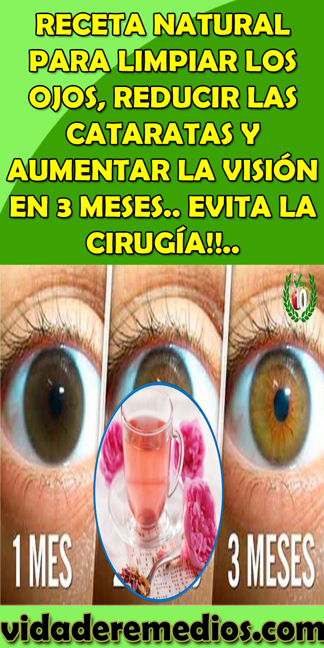 Descubre los mejores remedios caseros para limpiar tus ojos de forma natural