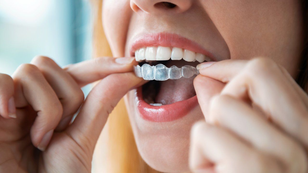 Limpiar tu ferula dental con bicarbonato: ¡Descubre cómo!
